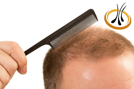 Miniaturización del pelo