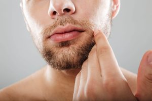 7 consideraciones antes de un trasplante de barba