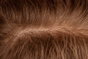Imagen que muestra de cerca un cabello y cuero cabelludo sanos